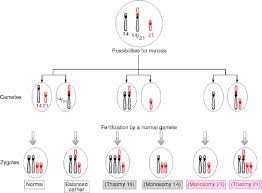 We did not find results for: Robertsonian Translocation