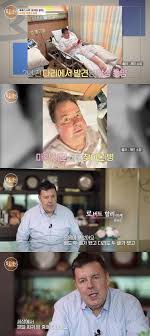 로버트 할리, 마약 논란 후 3년만에…희귀 신경암, 온몸 부어 : 네이트 연예