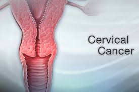 Therefore, in addition to having regular pap tests performed for screening purposes, a woman should learn to recognize possible warning signs so that she can bring them to the attention of her physician, dr tomar emphasises. 10 Warning Signs Of Cervical Cancer You Should Not Ignore The Ayi