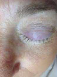 Baking soda acts as a cleaning agent to help scrub and lift impurities off your lash extensions. Caring For Your Eyelash Extensions My Beauty Salon Website