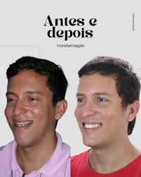 Bucomaxilo em Salvador