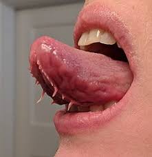 Fimbriated Fold Of Tongue Wikipedia