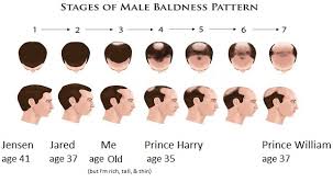 Jared tristan padalecki is an american actor. Observing And Speculating Have You Noticed Padalecki S Hairline Is Now