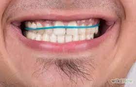 Luckily, orthodontics has entered the 21st century. How To Straighten Your Teeth Without Braces Teeth Straightening Diy Teeth Straightening Straighten Teeth Without Braces