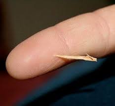 Splinter Splinter In Finger Splinter Removal Home Remedies