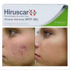 In conjunction with the sharing session, hiruscar also unveiled the hiruscar. Hiruscar Anti Acne Spot Gel And Post Acne Gel Shopee Malaysia