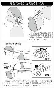 首が痛む 頸椎症 は治せる 医師考案 うなじ伸ばし で神経の圧迫を緩めよう カラダネ 首こり ストレッチ 健康 肩こり ストレッチ