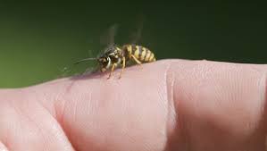 We did not find results for: 10 Brilliant Home Remedies For Bee Sting Ndtv Food