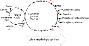Image result for Homocystinuria