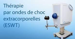 L'aponévrosite plantaire encore appelée fasciite plantaire est une inflammation de l'aponévrose ou fascia plantaire. Therapie Par Ondes De Choc Extracorporelles Eswt Im2s