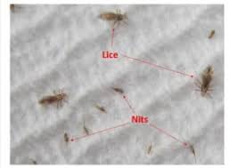 Image result for lice life cycle