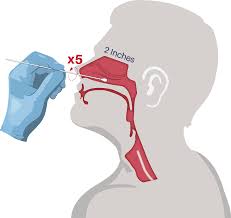 Covid 19 Nasal Swab Collection Clinical Pathology Laboratories