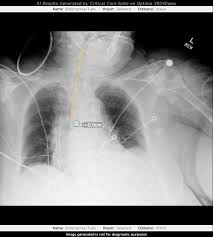 We did not find results for: Ge Healthcare Ge News