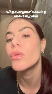 I ran out of my CO2 Mousse Moisturizer and didn’t realize how much my skin  missed it until I restocked. We’re talking next-level, glass skin in just a  few days., The secret? Carboxy therapy — a ...