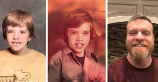 Instead, they simply hold your teeth in place. Do It Yourself Orthodonture Don T Try This At Home The New York Times