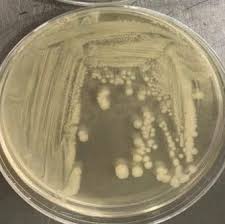 Image result for Shigella