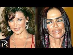 10 Plastic Surgery Cases That Went Too Far Youtube Bad Celebrity Plastic Surgery Plastic Surgery Fail Bad Plastic Surgeries