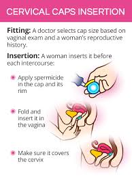 Image result for Cervical Cap