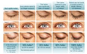 16 weeks eyelash growth latisse product for eyelashes lengthen grow fuller thicker lashes nyc ny los angeles ca. Latisse For Your Lashes Laser Skin Institute Chatam New Jersey