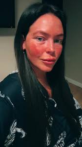 Orange from Tanning Bed