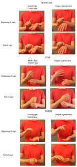 A Developmental Disorder of Signed Language Production in a Native Deaf  Signer of ASL