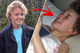 Kleine Levin Syndrome Extremely Rare Condition Causes People To Sleep For Weeks Express Co Uk