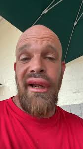 I fought the bees and the bees won 🏆 ￼#nofilter #squirreltreeman #flypシ  #palmtrees