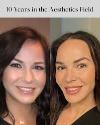 Robyn Roach (@holistic.beauty.nurse) • Instagram photos and videos