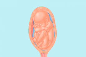 Twins baby pregnancy tips in urdu. What Is Breech Presentation Parents
