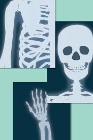 Illustrated X Ray Posters Role Play Scenarios X Ray Preschool Activities