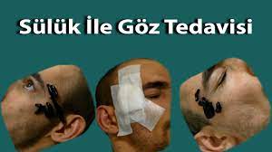 Suluk Ile Goz Tedavisi Youtube