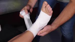 Immobilisation stricte par attelle rigide montée sur chaussure bmt 1 axmed® â si trait de fracture à 1.5 cm au dessus de la surface articulaire, c'est systématiquement une fracture de fatigue (attention si le patient réclame la. Entorses Symptomes Traitement Definition Docteurclic Com