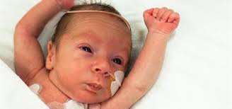 Image result for Preterm Infant Growth