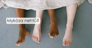 Image result for mykoza nehtů