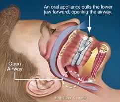 20186 Dentist John W Harre Dds Pc Of Warrenton Sleep Apnea Treatment