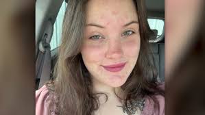 3 charged in connection with resident who froze to death