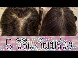 5 ว ธ ลดผมร วง ใครห วล าน ผมบาง ผมน อย ห วเถ ก เช ญม งค ะ cozy t youtube