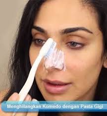 Cara Menghilangkan Komedo Secara Alami Dan Permanen Super Kilat Menghilangkan Komedo Hitam Putih Yang Membandel Menghilangkan Komedo D Komedo Kesehatan Alam