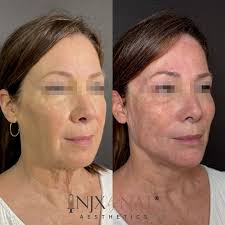 INJX by Nat Aesthetics added a...