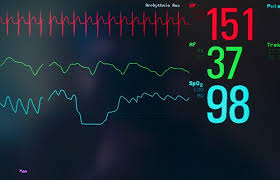 Image result for Heart Rate