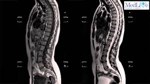 We did not find results for: Cum Functioneaza Aparatul De Rezonanta Magnetica Irm Si Ce Afectiuni Poate Depista Video Medlife