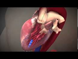 Stenoza aortică reprezintă îngustarea orificiului acestei valve. Implantare De ValvÄ AorticÄ Tavi Prin Abord Transapical Youtube