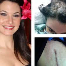 Fundraiser by Justine Chichester : Justine's Fight to Walk Again