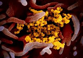 A coronavirus is a common virus that causes an infection in your nose, sinuses, or upper throat. The World Learned About A New Coronavirus 5 Months Ago Here S What We Now Know About Covid 19