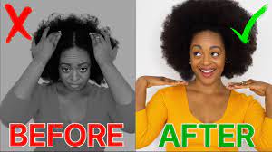 Dandruff and seborrheic dermatitis are the most common when it comes to itchy scalp causes. Dry Itchy Scalp Cure It Fast 4c Natural Hair Youtube