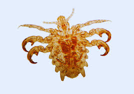 Image result for pubic lice symptoms