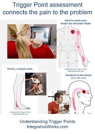 Fi Blog Posts 5 Trigger Points Muscles Of The Neck Shoulder Trigger Points