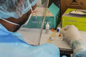 Rapid antigen tests check for proteins on the virus's surface and are popular for their quick turnaround times, but are rarely accepted. Fast Facts What S The Difference Between Pcr Rapid Antibody Tests