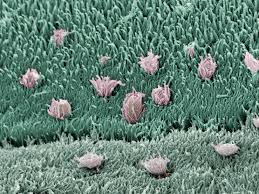 Inferior, middle and superior nasal conchae (turbinates) superiorly: Parasitic Infections Of The Central Nervous System