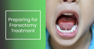 Preparing For Frenectomy Treatment Milltown Dental